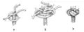 Matthew Walker knot