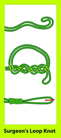 Surgeon's loop